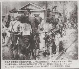 ◆広島の被爆直後の貴重な写真　巡査が熱傷の部分に応急処置　.gif